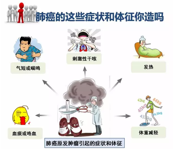 郑州看肺癌好的中医